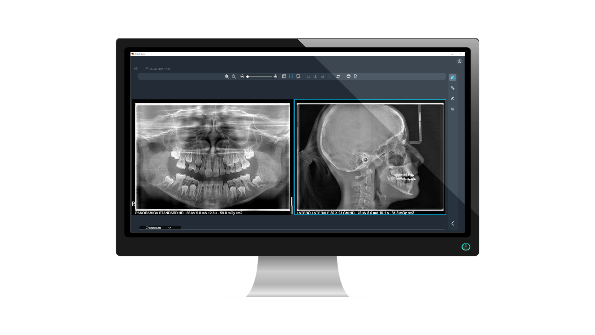 X-Mind™ Prime 3D