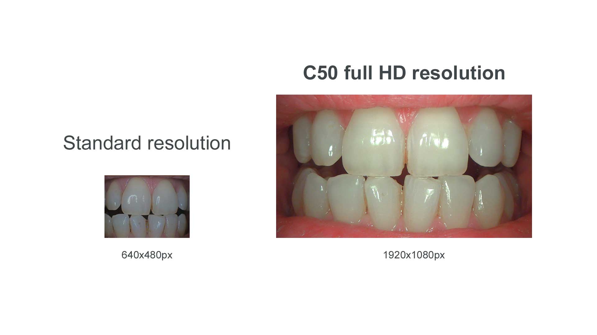 Acteon C50 Intra-oral Full HD Camera without diagnostic aid