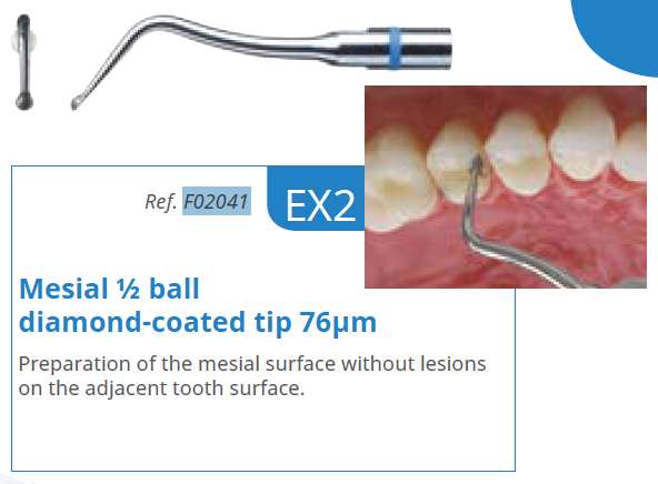 Satelec - EX2 Tip